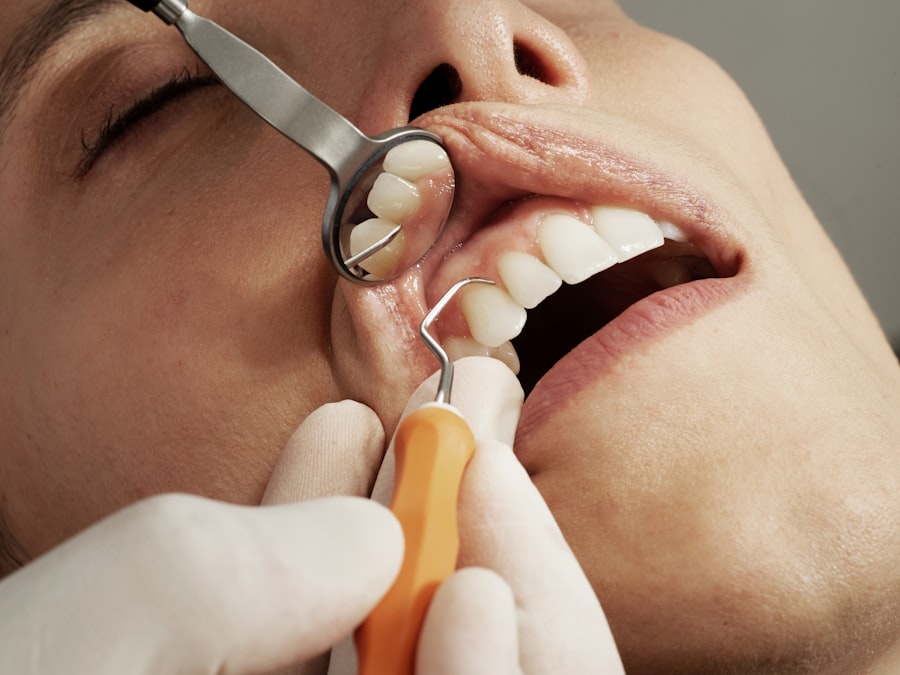 Family dental care at Venice Family Clinic